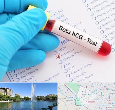 آزمایشگاه بارداری در کوهسنگی مشهد