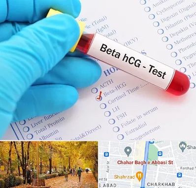 آزمایشگاه بارداری در چهارباغ اصفهان