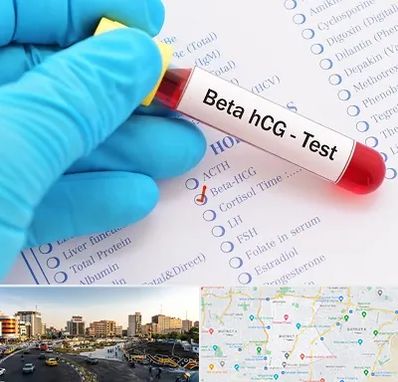 آزمایشگاه بارداری در منطقه 7 تهران 