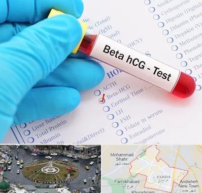 آزمایشگاه بارداری در فردیس کرج 