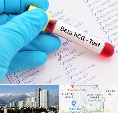 آزمایشگاه بارداری در شهرک غرب 