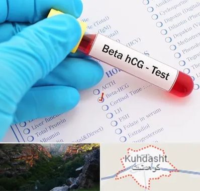 آزمایشگاه بارداری در کوهدشت