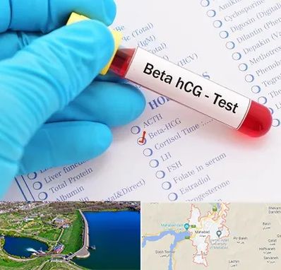 آزمایشگاه بارداری در مهاباد