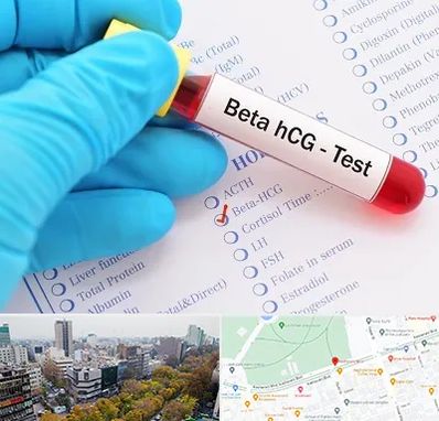 آزمایشگاه بارداری در بلوار کشاورز 