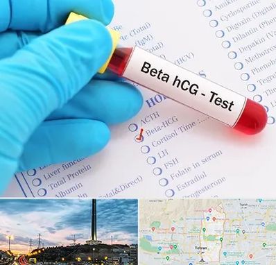 آزمایشگاه بارداری در منطقه 2 تهران 