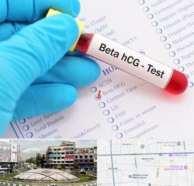 آزمایشگاه بارداری در مرکز تهران