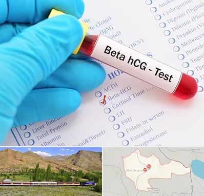 آزمایشگاه بارداری در خاش