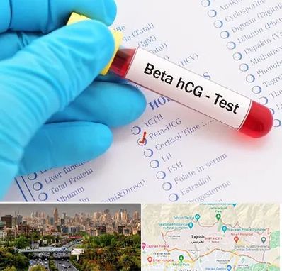 آزمایشگاه بارداری در منطقه 1 تهران 