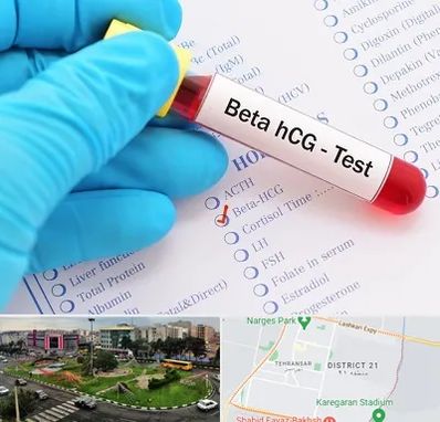 آزمایشگاه بارداری در تهرانسر 