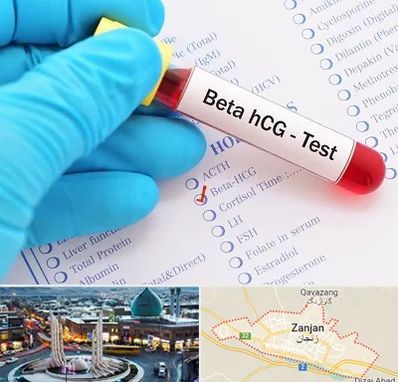 آزمایشگاه بارداری در زنجان