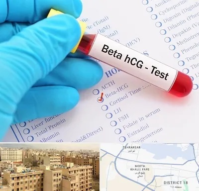 آزمایشگاه بارداری در جنوب غرب تهران