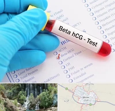 آزمایشگاه بارداری در شیروان