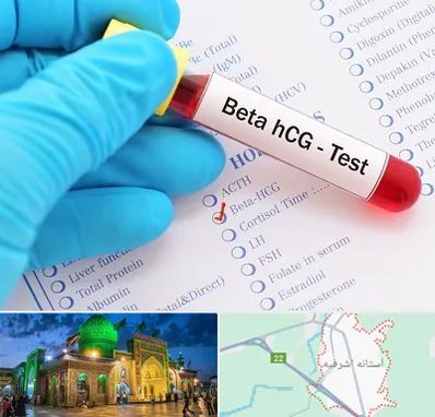 آزمایشگاه بارداری در آستانه اشرفیه