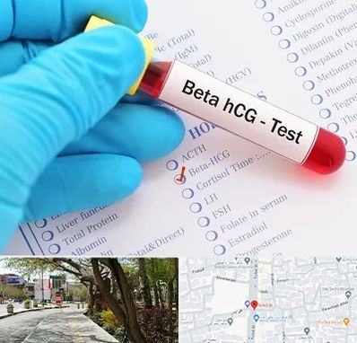 آزمایشگاه بارداری در خیابان توحید اصفهان