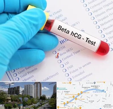 آزمایشگاه بارداری در اندرزگو