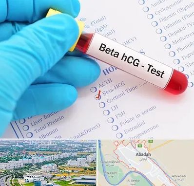 آزمایشگاه بارداری در آبادان