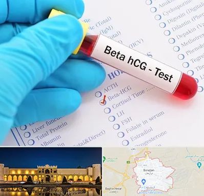 آزمایشگاه بارداری در برازجان