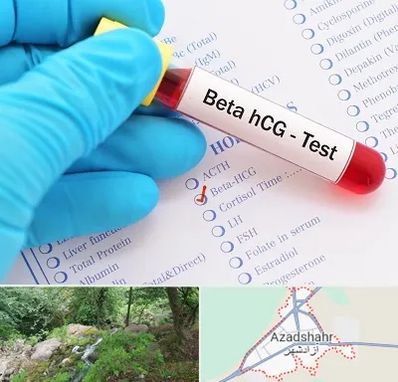 آزمایشگاه بارداری در آزادشهر