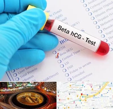 آزمایشگاه بارداری در میدان ولیعصر 