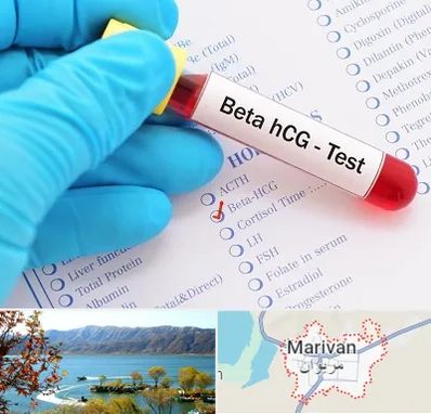 آزمایشگاه بارداری در مریوان