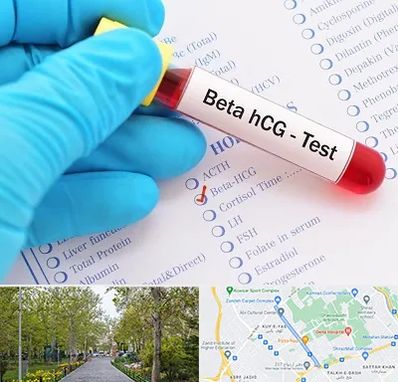 آزمایشگاه بارداری در قدوسی غربی شیراز