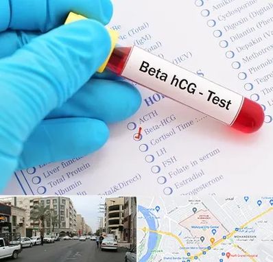 آزمایشگاه بارداری در زیتون کارمندی اهواز