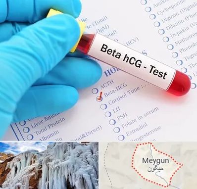 آزمایشگاه بارداری در میگون