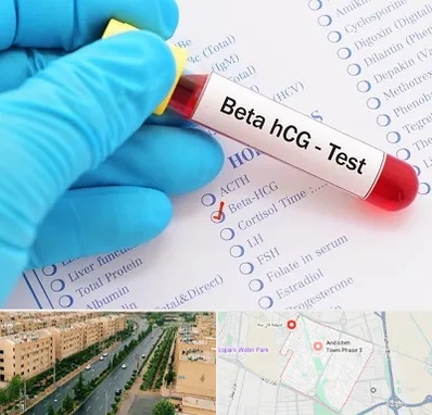 آزمایشگاه بارداری در فاز سه اندیشه