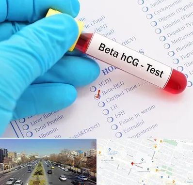 آزمایشگاه بارداری در بلوار معلم مشهد