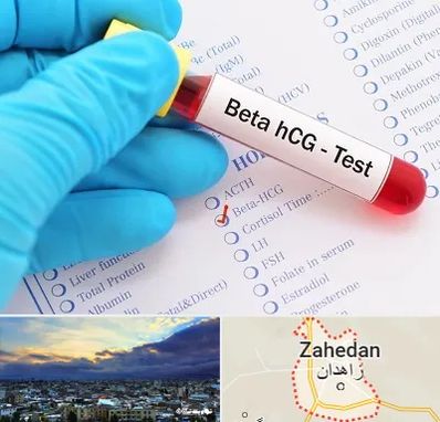 آزمایشگاه بارداری در زاهدان