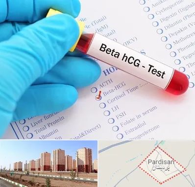 آزمایشگاه بارداری در پردیسان قم