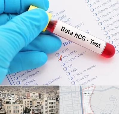 آزمایشگاه بارداری در اسکندری