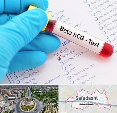 آزمایشگاه بارداری در صفادشت