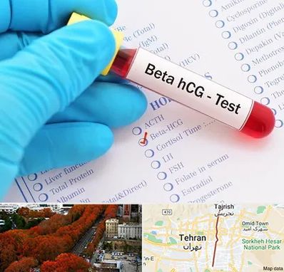 آزمایشگاه بارداری در ولیعصر 