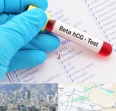 آزمایشگاه بارداری در شمال شرق تهران