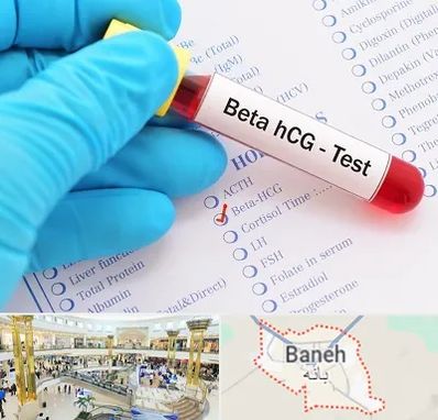 آزمایشگاه بارداری در بانه
