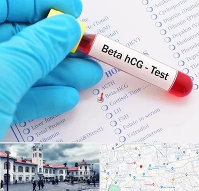 آزمایشگاه بارداری در میدان شهرداری رشت