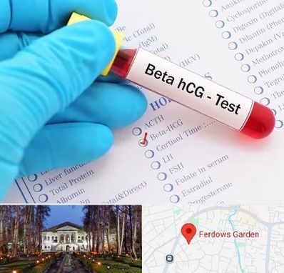آزمایشگاه بارداری در باغ فردوس