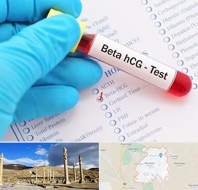 آزمایشگاه بارداری در مرودشت