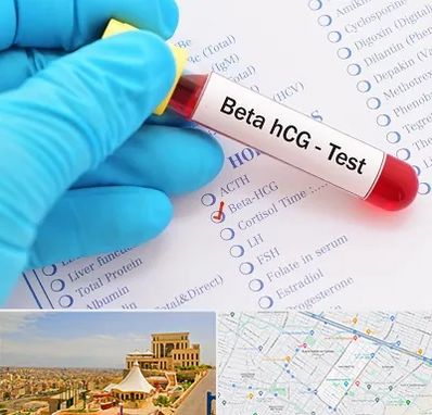 آزمایشگاه بارداری در هاشمیه مشهد