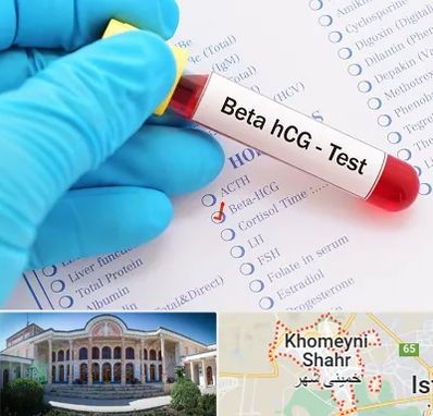 آزمایشگاه بارداری در خمینی شهر