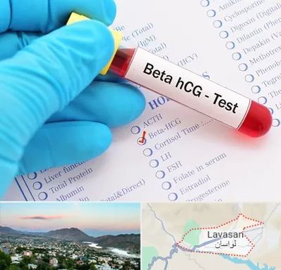 آزمایشگاه بارداری در لواسان
