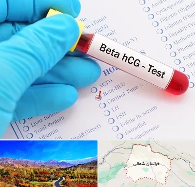 آزمایشگاه بارداری در خراسان شمالی