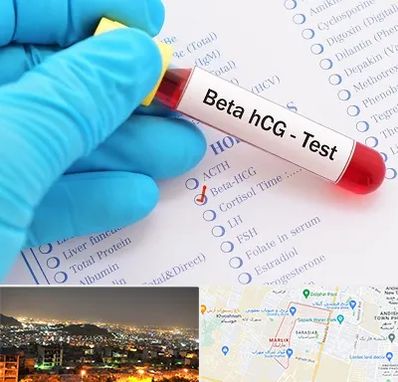 آزمایشگاه بارداری در مارلیک کرج