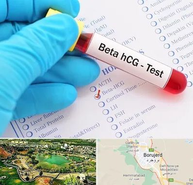 آزمایشگاه بارداری در بروجرد