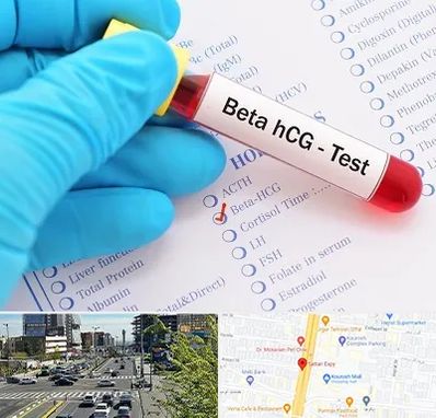 آزمایشگاه بارداری در ستاری 