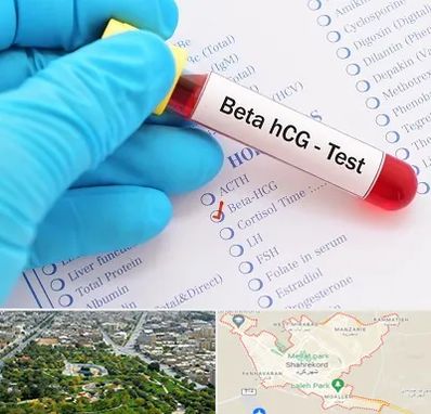 آزمایشگاه بارداری در شهرکرد