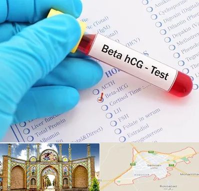 آزمایشگاه بارداری در سمنان