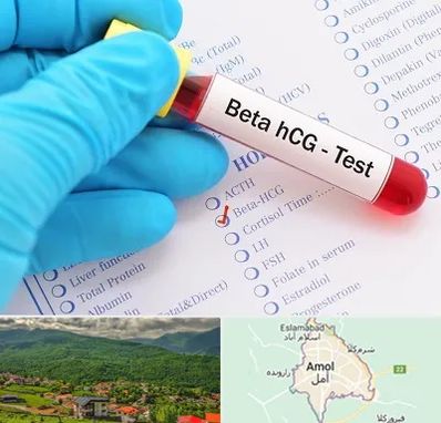 آزمایشگاه بارداری در آمل