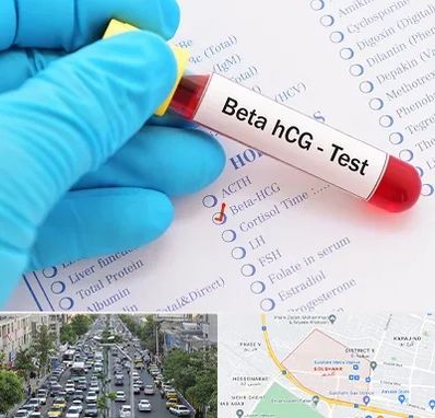 آزمایشگاه بارداری در گلشهر کرج